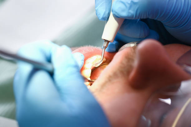 Best Emergency Treatment for Toothache in Bath, PA